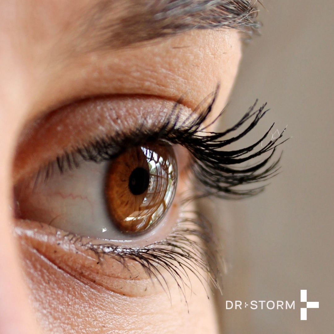 Eyelash Growth Serum Consultation